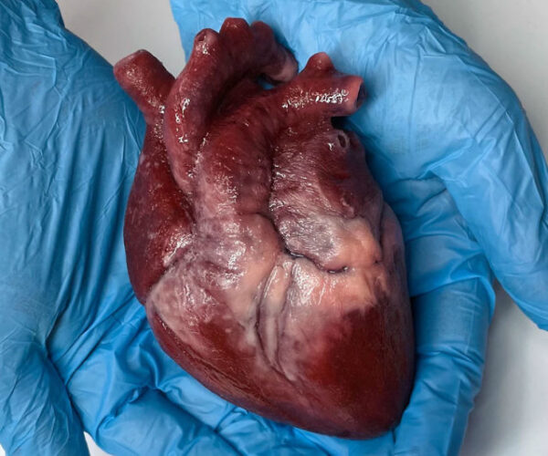 silicone heart
